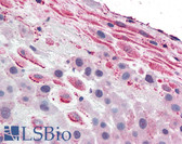 Anti-TLR4 Antibody (Internal) IHC-plus LS-A9704