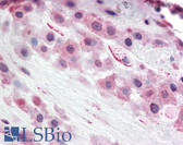 Anti-TLR4 Antibody (Internal) IHC-plus LS-A9705