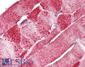 Anti-SLC5A6 / SMVT Antibody (Internal) IHC-plus LS-A9767