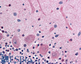 Anti-COMT Antibody (Internal) IHC-plus LS-A9769