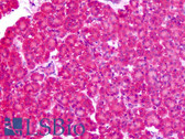 Anti-SLC1A4 / ASCT1 Antibody (N-Terminus) IHC-plus LS-A9772