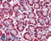Anti-STEAP4 Antibody (N-Terminus) IHC-plus LS-A9773
