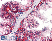 Anti-SLC1A5 / ASCT2 Antibody (C-Terminus) IHC-plus LS-A9774