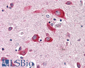 Anti-ENTPD2 Antibody (Internal) IHC-plus LS-A9775