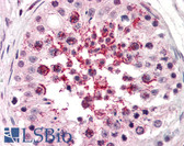 Anti-ADAM20 Antibody (Internal) IHC-plus LS-A9788