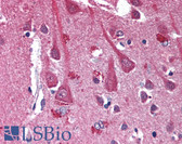 Anti-CXCR4 Antibody (clone 12G5) IHC-plus LS-B1986