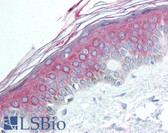 Anti-HDAC4 Antibody (N-Terminus) IHC-plus LS-B1999