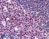 Anti-MCM6 Antibody IHC-plus LS-B2008