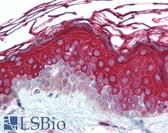 Anti-ALAS1 Antibody (aa480-530) IHC-plus LS-B2013