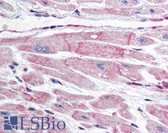 Anti-BIRC7 / Livin Antibody (clone 88C570) IHC-plus LS-B2018