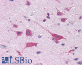 Anti-DAP-5 / EIF4G2 Antibody (aa796-812, clone 39C534.1) IHC-plus LS-B2026