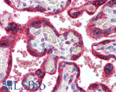 Anti-HSPA5 / GRP78 / BiP Antibody (aa550-600) IHC-plus LS-B2038