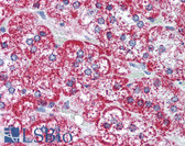 Anti-HSPD1 / HSP60 Antibody (aa350-400) IHC-plus LS-B2039