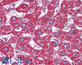 Anti-HSPD1 / HSP60 Antibody (aa150-200) IHC-plus LS-B2040