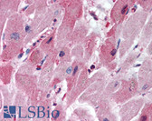 Anti-HTR3A / 5-HT3A Receptor Antibody (aa21-36) IHC-plus LS-B2042