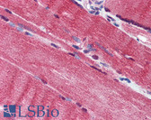Anti-DCAF6 / NRIP Antibody (aa800-850) IHC-plus LS-B2046