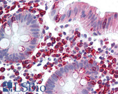 Anti-LTK Antibody (aa800-864) IHC-plus LS-B2050