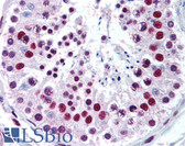 Anti-MECP2 Antibody (aa11-25) IHC-plus LS-B2054