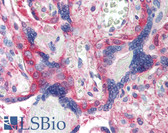 Anti-SH3GLB1 / Bif / Endophilin B1 Antibody (clone 30A882.1.1) IHC-plus LS-B2059