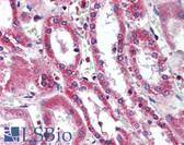 Anti-SIRT5 / Sirtuin 5 Antibody (aa30-46) IHC-plus LS-B2060