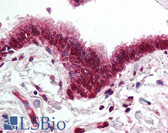 Anti-SKIL / SNO / SnoN Antibody (aa600-684) IHC-plus LS-B2062