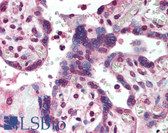 Anti-SMAD2 Antibody (aa234-249) IHC-plus LS-B2063