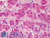 Anti-SMAD3 Antibody (aa100-150) IHC-plus LS-B2064