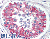 Anti-SMAD6 Antibody (aa85-99) IHC-plus LS-B2065