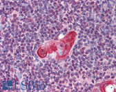 Anti-TLX1 / HOX11 Antibody (aa306-318) IHC-plus LS-B2071