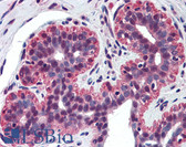 Anti-TP73 / p73 Antibody (N-Terminus, clone 5B429) IHC-plus LS-B2086