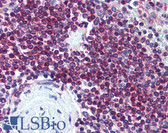 Anti-BCAP31 / BAP31 Antibody (clone CC-1) IHC-plus LS-B2117