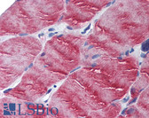 Anti-MYO5B / Myosin VB Antibody (N-Terminus) IHC-plus LS-B2119