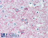 Anti-ADORA2A/Adenosine A2A Receptor Antibody (3rd Intracellular Domain) IHC-plus LS-B2122