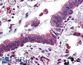 Anti-ERBB3 / HER3 Antibody (C-Terminus) IHC-plus LS-B2126