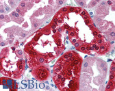 Anti-CA2 / Carbonic Anhydrase II Antibody (HRP) IHC-plus LS-B2131