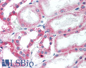 Anti-HSD2 / HSD11B2 Antibody (aa25-40) IHC-plus LS-B2135