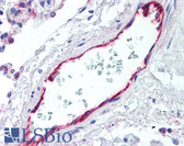 Anti-CD144 / CDH5 / VE Cadherin Antibody (aa1-258) IHC-plus LS-B2138
