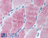 Anti-ARL6 Antibody (N-Terminus) IHC-plus LS-B2142