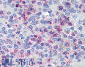 Anti-CXCR4 Antibody (aa182-196) IHC-plus LS-B2160