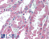 Anti-Endostatin Antibody (C-Terminus) IHC-plus LS-B2163