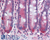 Anti-MMP11 Antibody (clone SL3.05) IHC-plus LS-B2166