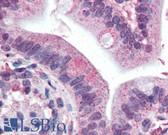 Anti-SLPI Antibody IHC-plus LS-B2174