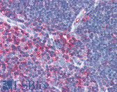 Anti-MSN / Moesin Antibody IHC-plus LS-B2180