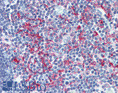 Anti-LSP1 Antibody (aa37-48) IHC-plus LS-B2190