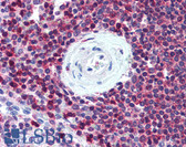 Anti-SLC9A3R1 / NHERF1 / EBP50 Antibody IHC-plus LS-B2196