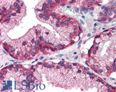 Anti-EGFR Antibody (Internal) IHC-plus LS-B2199