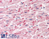 Anti-JUP/CTNNG/Junction Plakoglobin Antibody (C-Terminus) IHC-plus LS-B2204