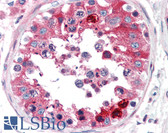 Anti-CLU / Clusterin Antibody IHC-plus LS-B2218