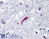 Anti-Myelin Basic Protein / MBP Antibody (aa130-136) IHC-plus LS-B2231