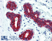 Anti-Pan Cytokeratin Antibody (clone C-11) IHC-plus LS-B2238